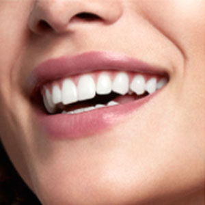 Oral-b braun pro series 3 3500 Электрическая зубная щетка d505.513.3x Oral-b braun pro series 3 3500 Электрическая зубная щетка d505.513.3x